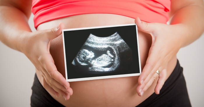 Woman holding an ultrasound scan of her unborn baby; blog: what happens if my baby is breech