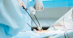 Close up of hands of surgeons team during operation uterus removal with surgical laparoscopy instruments. Gynecology.