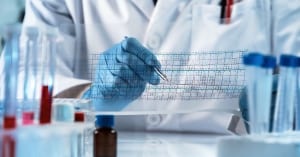 genetic engineering reading the structure chart with the results of the test / doctor analyzing DNA sequence results analysis graph; Prenatal Genetic Screening